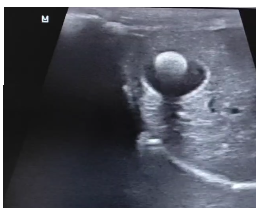 узи рис 1.png узи рис 1.png